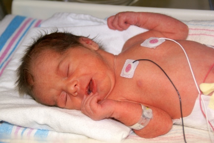 premature infant in NICU