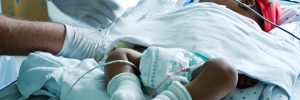 Premature and Medically Complex Neonates: Applying Critical Thinking to Support Long-term Outcomes