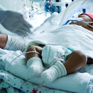 Premature and Medically Complex Neonates: Applying Critical Thinking to Support Long-term Outcomes